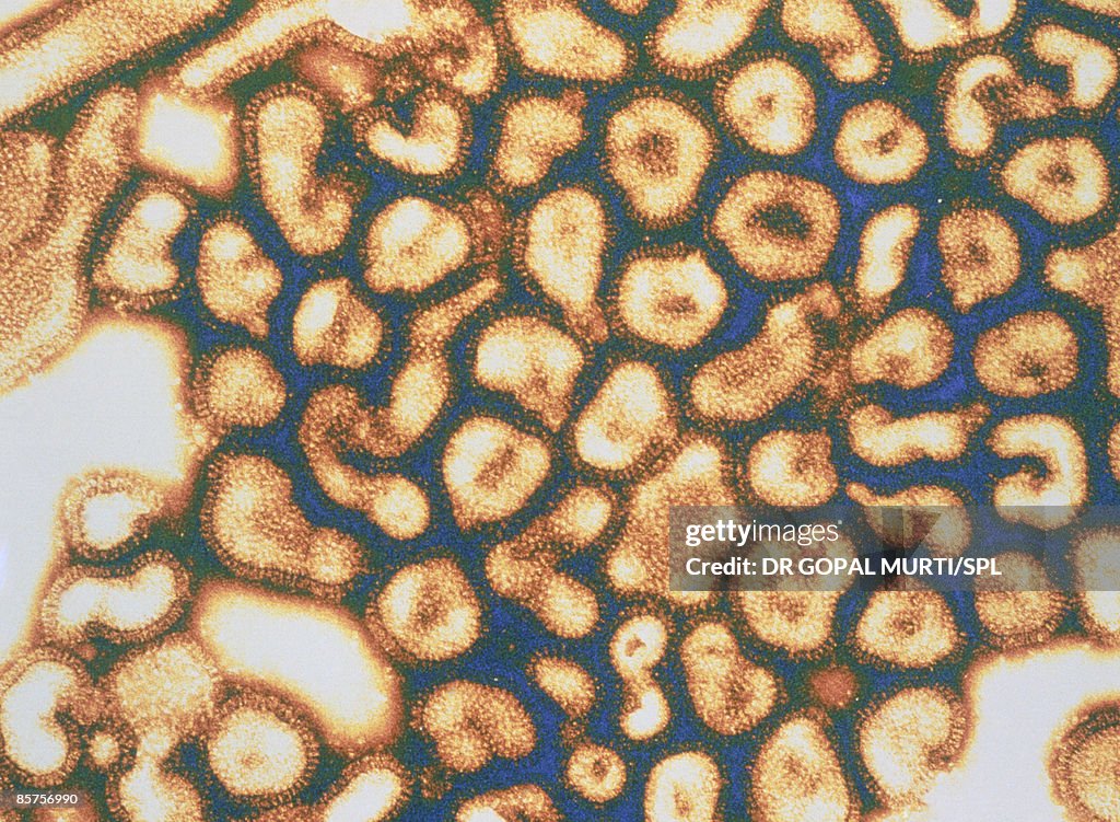 Transmission Electron Micrograph (TEM) of flu virus