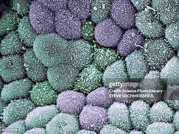 internal lining of the gall bladder - mucus stock pictures, royalty-free photos & images