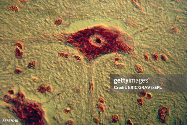 light micrograph of nerve cell from human spinal cord - dendrit stock-fotos und bilder