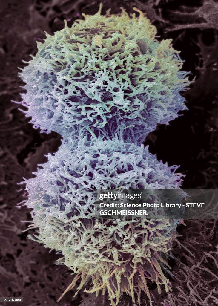 Cervical cancer cell