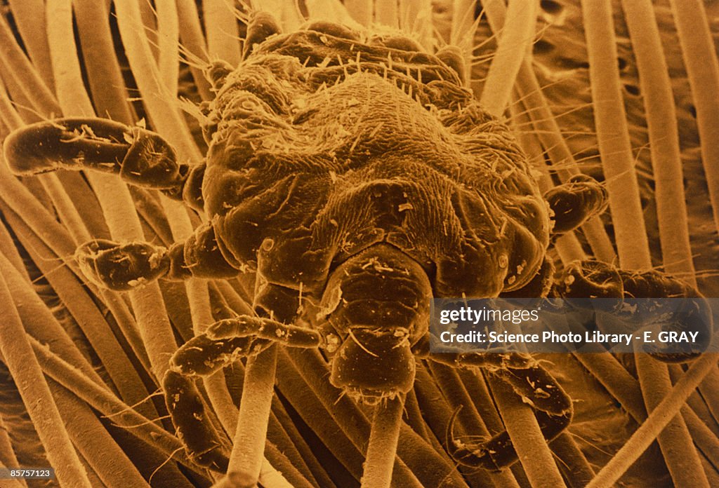 Colored scanning electron micrograph of pubic louse