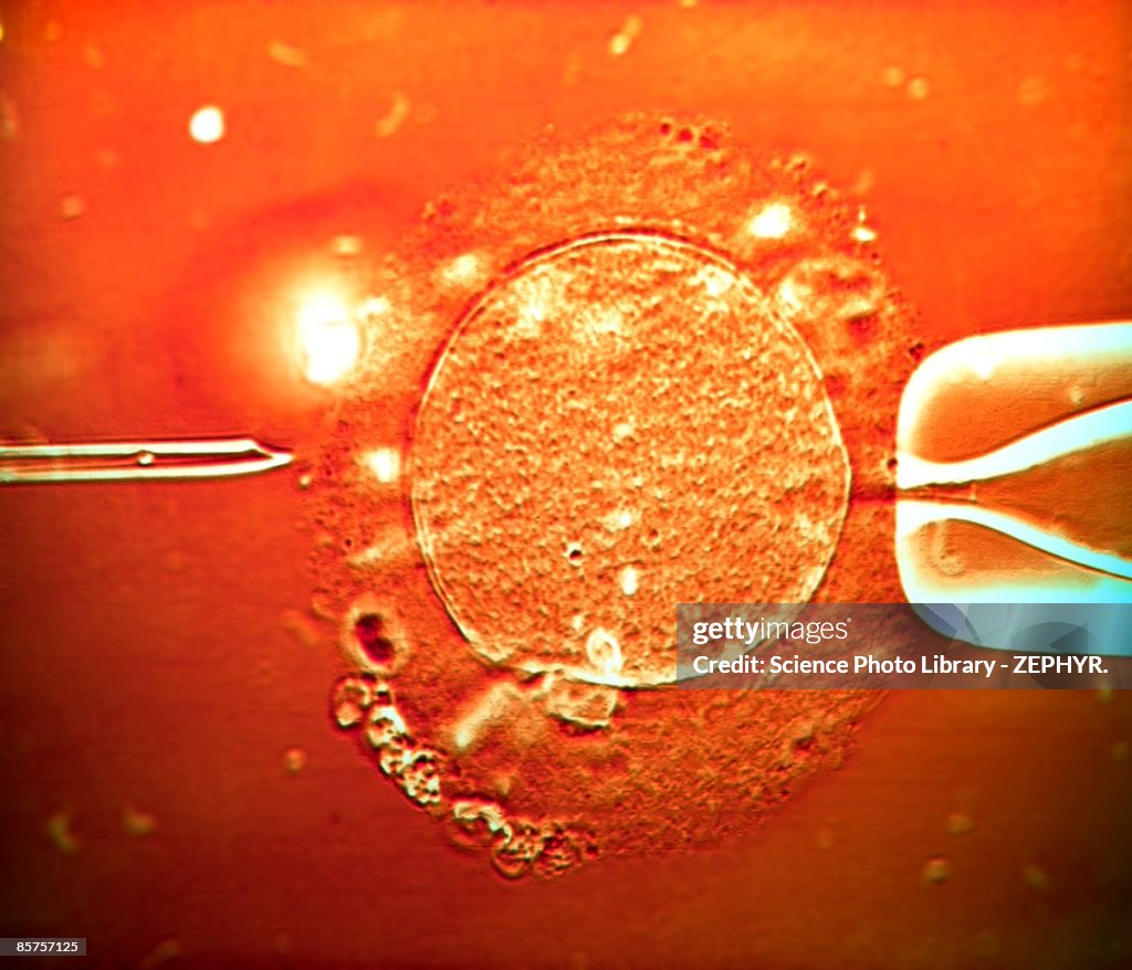 IVF treatment sperm being injected into human egg