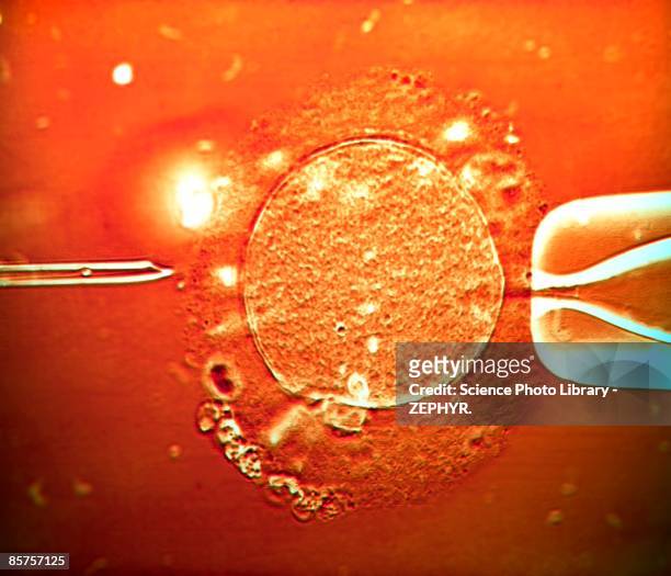 ivf treatment sperm being injected into human egg - human sperm and ovum stock pictures, royalty-free photos & images