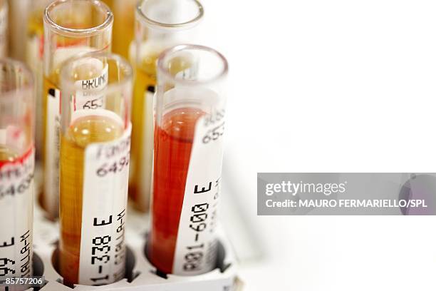 blood samples - aids imagens e fotografias de stock