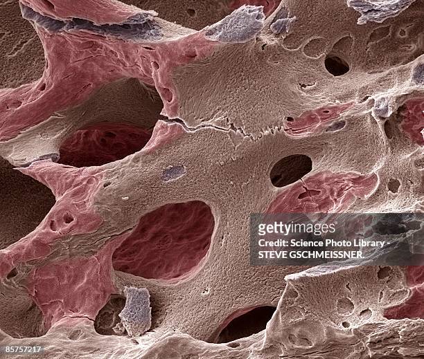 scanning electron micrograph (sem) of human bone, osteoporosis - wissenschaftliche mikroskopische aufnahme stock-fotos und bilder