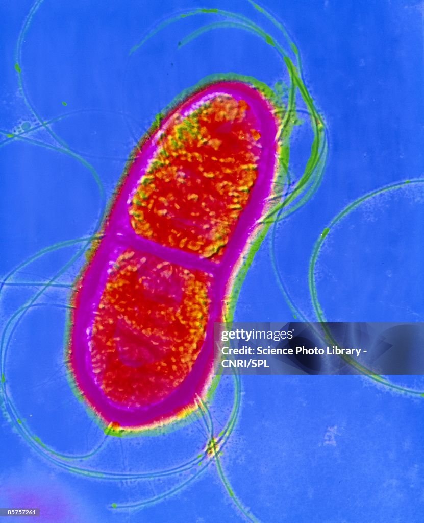 False-color shadow transmission electron micro-graph (TEM)