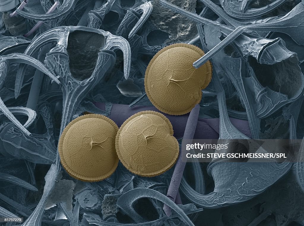 Prorocentrum and dinoflagellates
