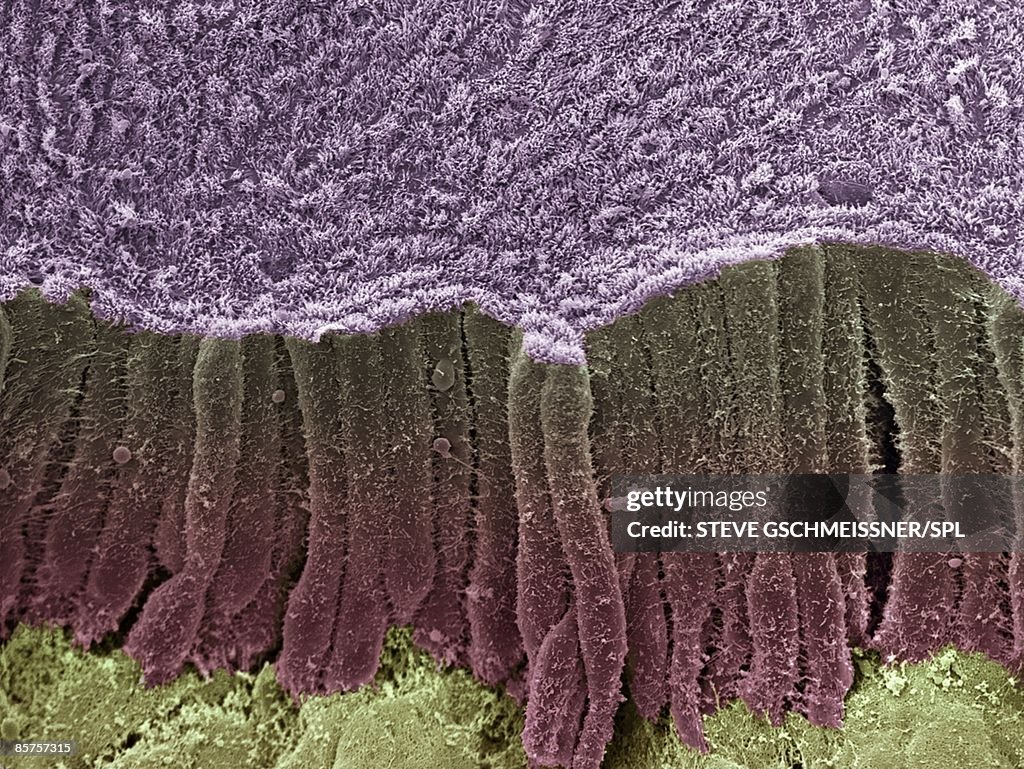 Colored scanning electron micrograph