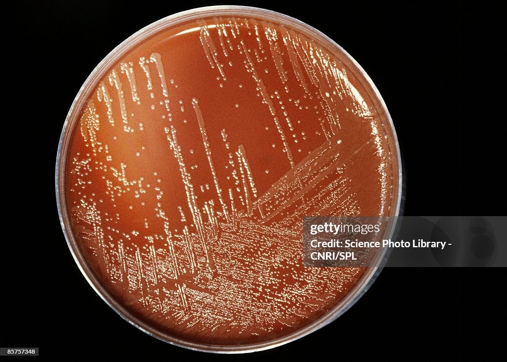 Meningitis bacteria