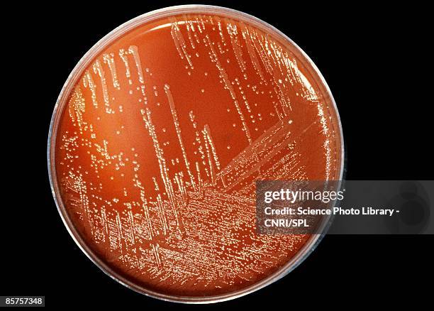 meningitis bacteria - enterobacter aerogenes stock pictures, royalty-free photos & images