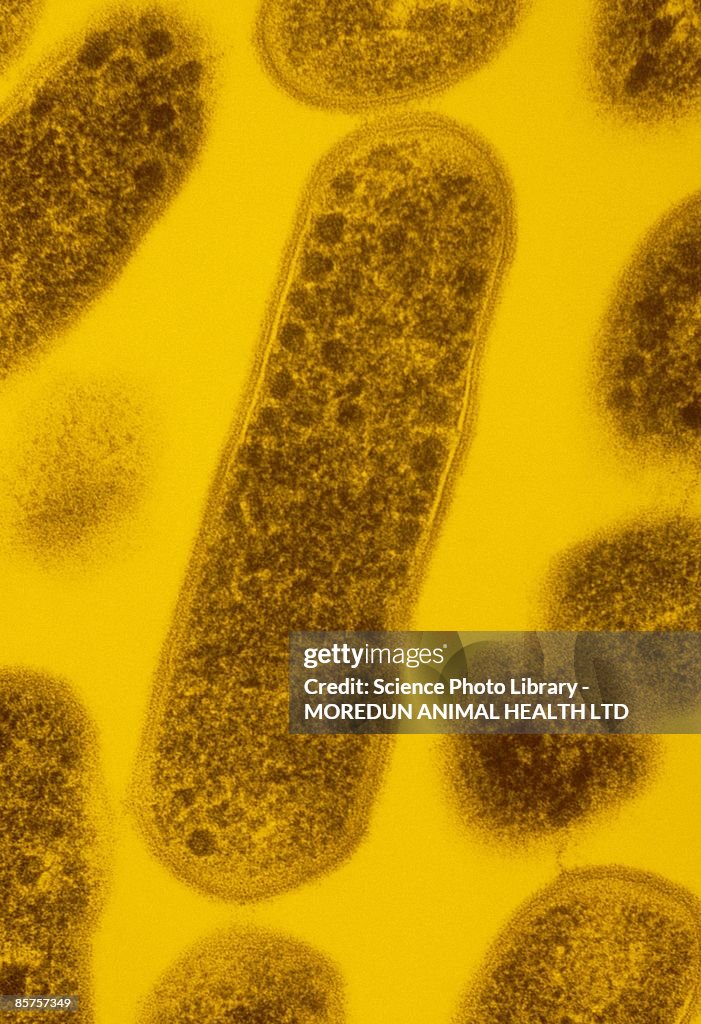 False-color transmission electron micrograph