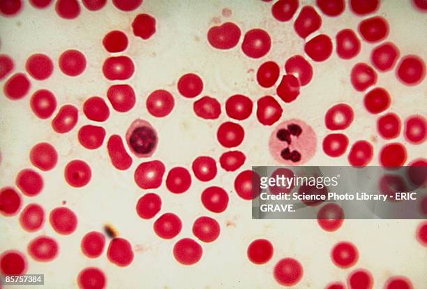 light micrograph of red and white blood cell - globulos rojos humanos fotografías e imágenes de stock