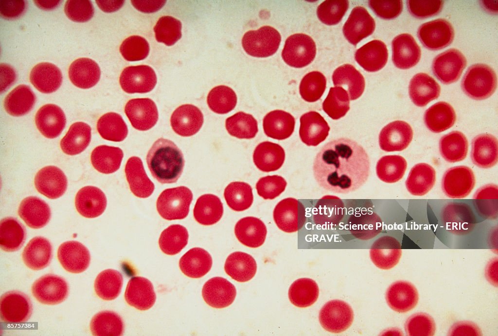 Light micrograph of red and white blood cell