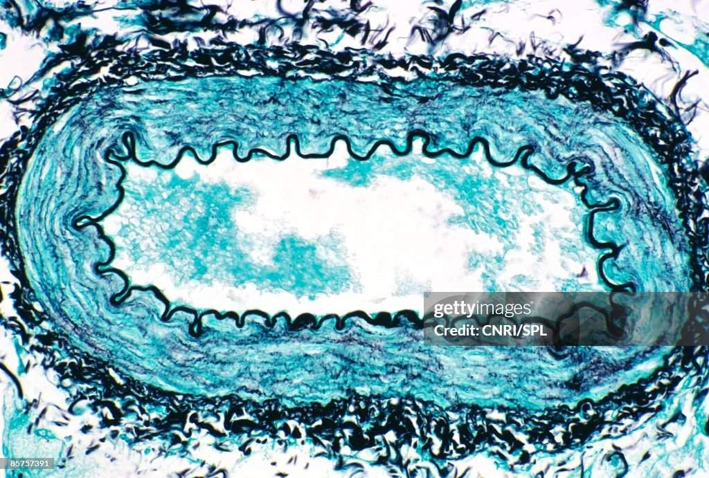 Light micrograph of human artery