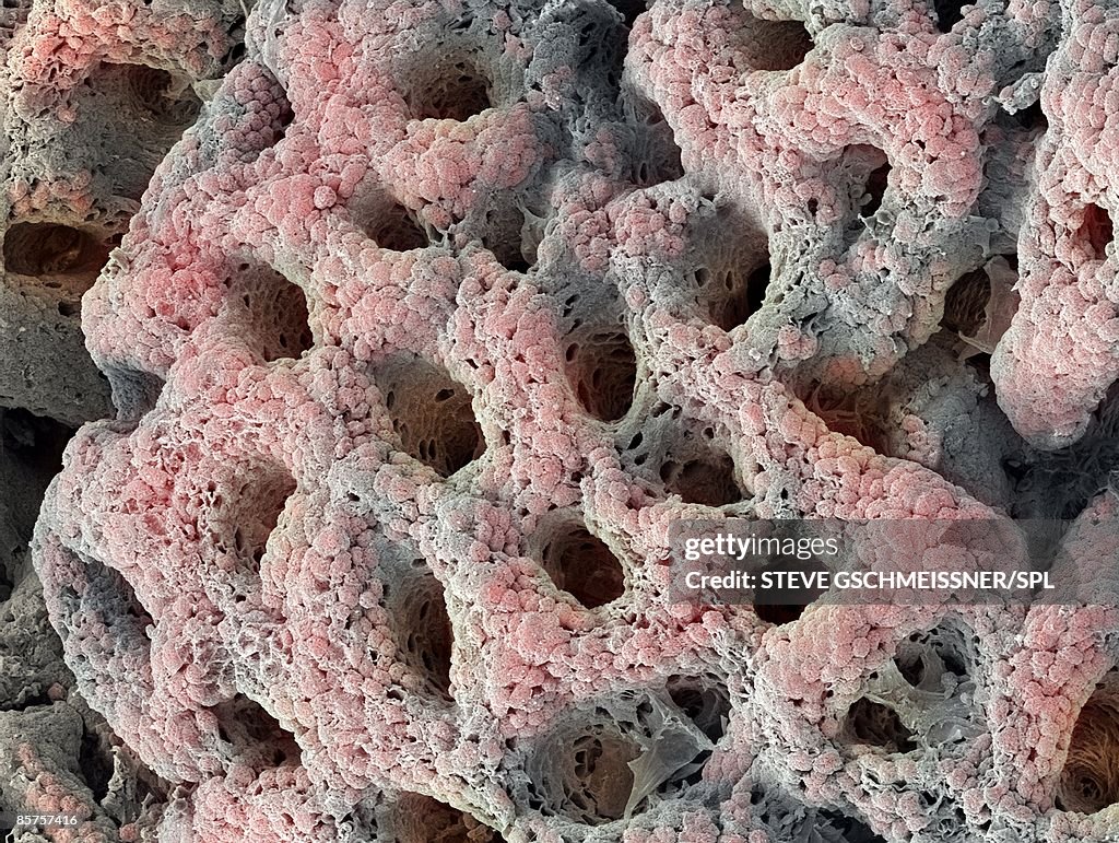Stomach lining