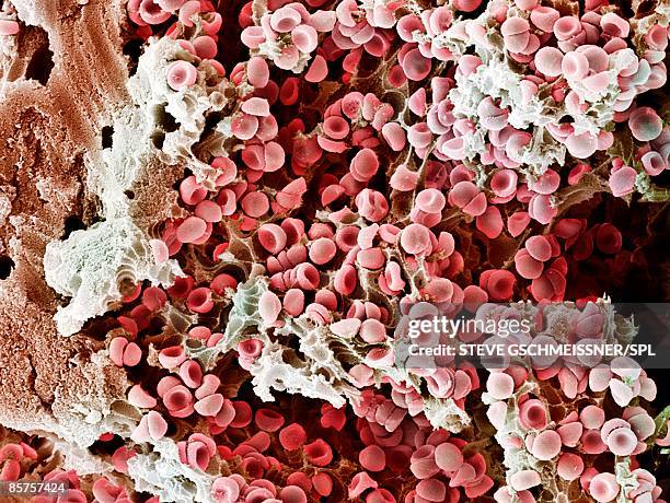 scanning electron microscope (sem) of red blood cell - fibrin fotografías e imágenes de stock