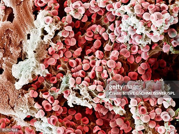 scanning electron microscope (sem) of red blood cell - fibrin - fotografias e filmes do acervo