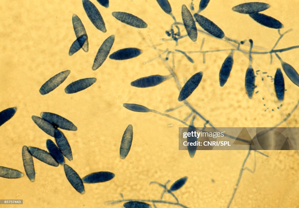 Light micrograph of the fungus