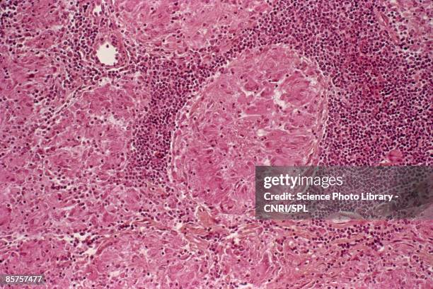 tuberculosis - macrophage stock pictures, royalty-free photos & images