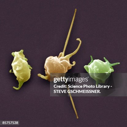 Activated platelets, colored scanning electron micrograph (SEM) Activated platelets, colored scanning electron micrograph (SEM)