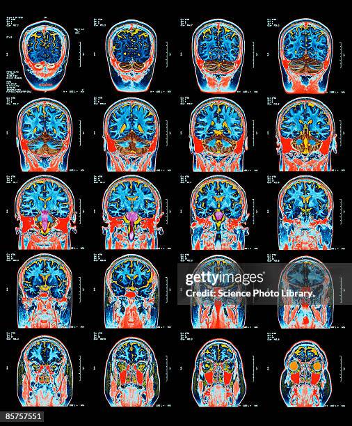 stockillustraties, clipart, cartoons en iconen met mri scan of brain - mri scan medische scan