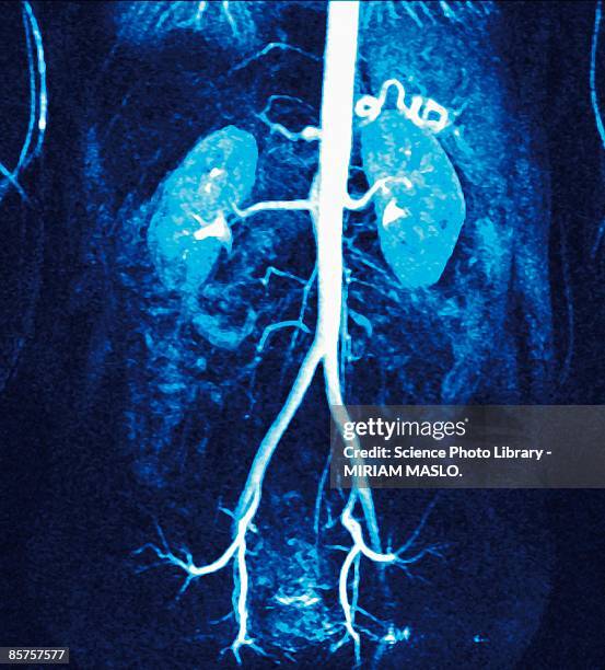 renal arteries - human kidney stockfoto's en -beelden