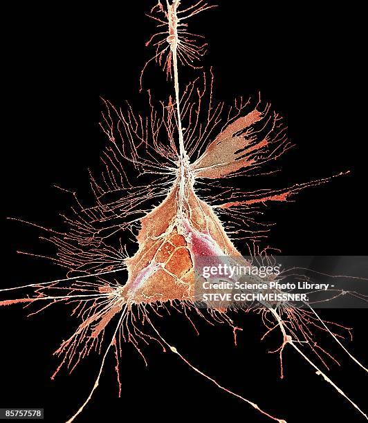 nerve support cell, sem - micrografía electrónica escaneadora fotografías e imágenes de stock