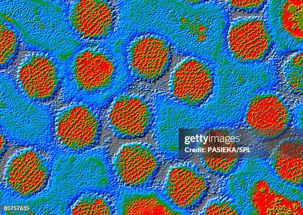 colored transmission electron micrograph (tem) of adenovirus particles - adenovirus stock-fotos und bilder