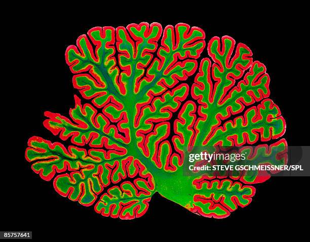 light micrograph of brain - 光学顕微鏡図点のイラスト素材／クリップアート素材／マンガ素材／アイコン素材