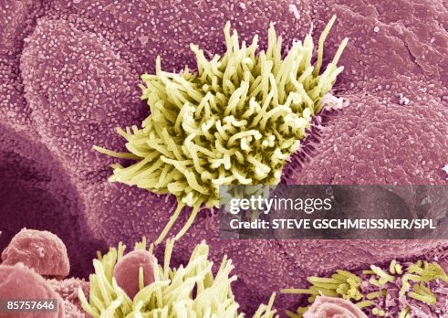 Trachea lining, colored scanning electron micrograph Trachea lining, colored scanning electron micrograph