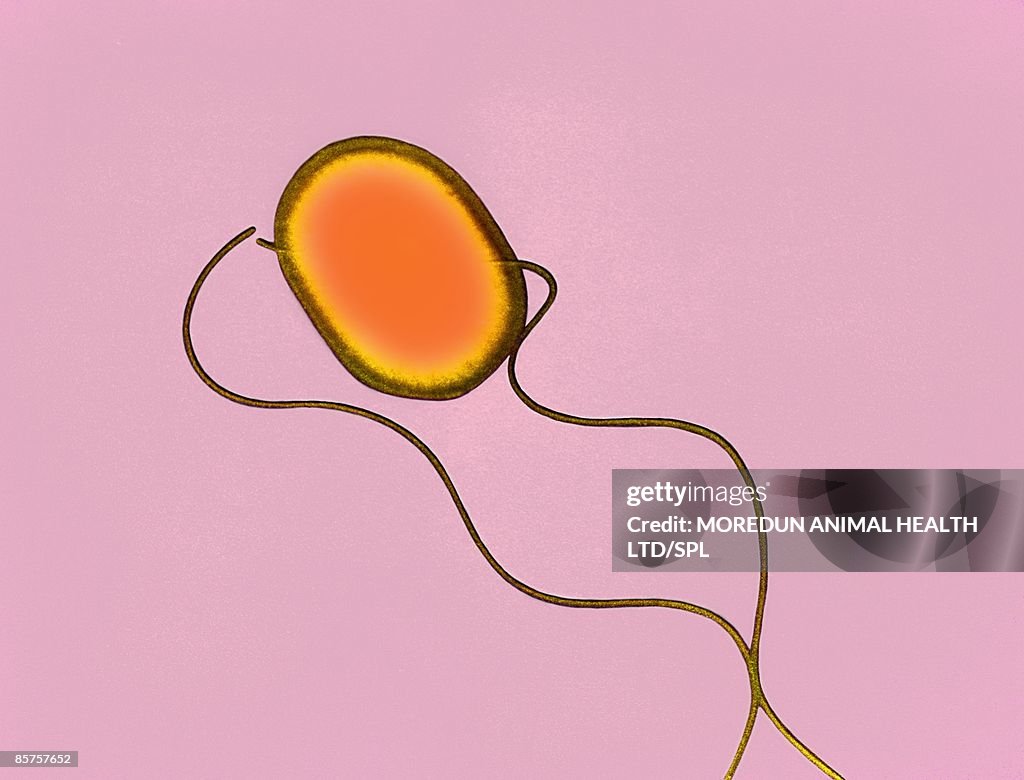 Colored transmission electron micrograph (TEM)