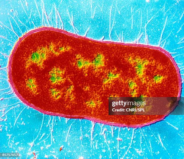 false color transmission electron micrograph(tem) - micrografia eletrónica de transmissão imagens e fotografias de stock