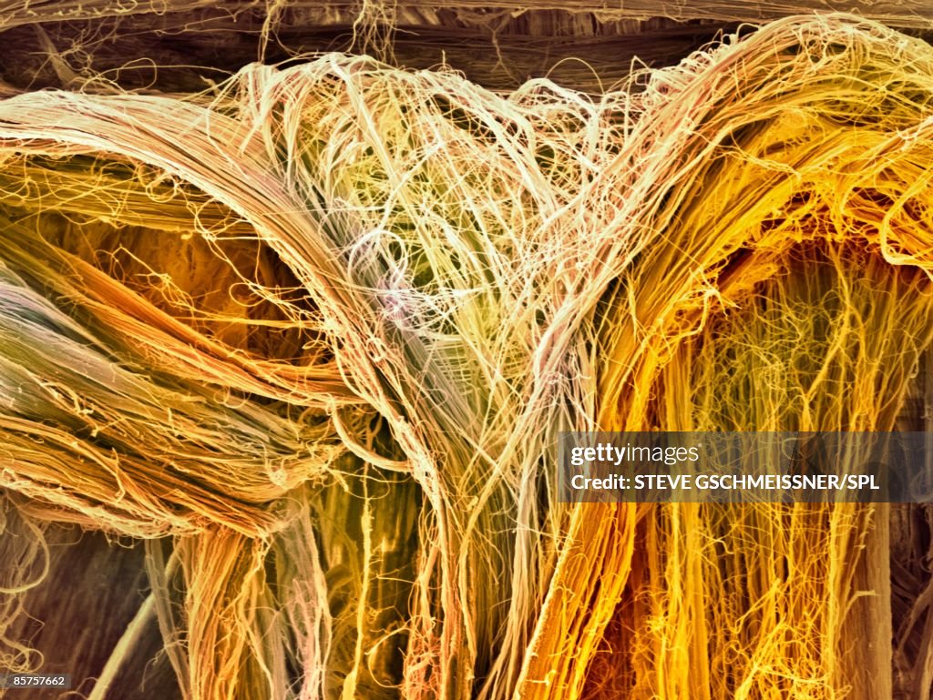 Scanning electron microscope (SEM) of tendon