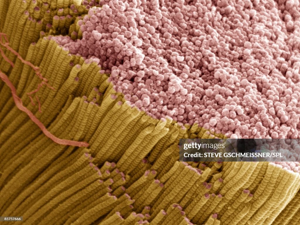 Tendon, scanning electron microscope (SEM)