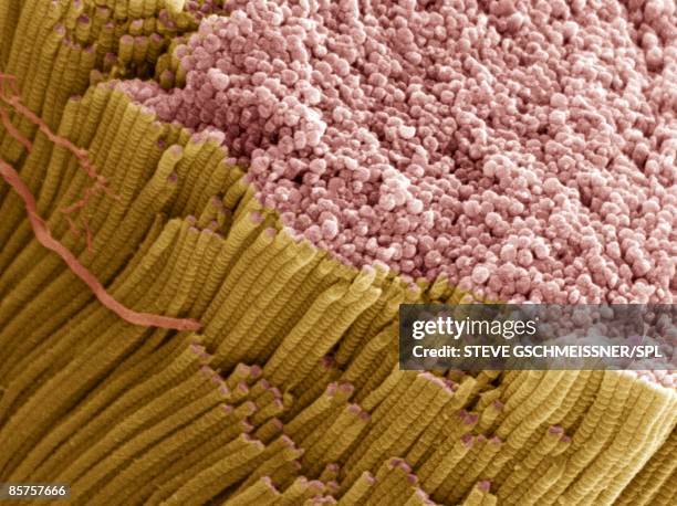 Collagen Fibers Electron Micrograph Photos and Premium High Res ...