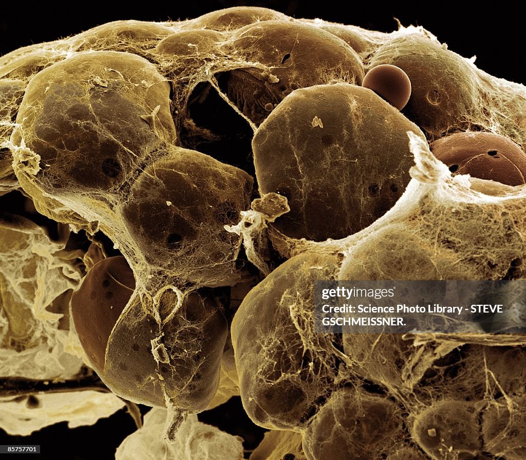 Fat tissue, colored scanning electron micrograph