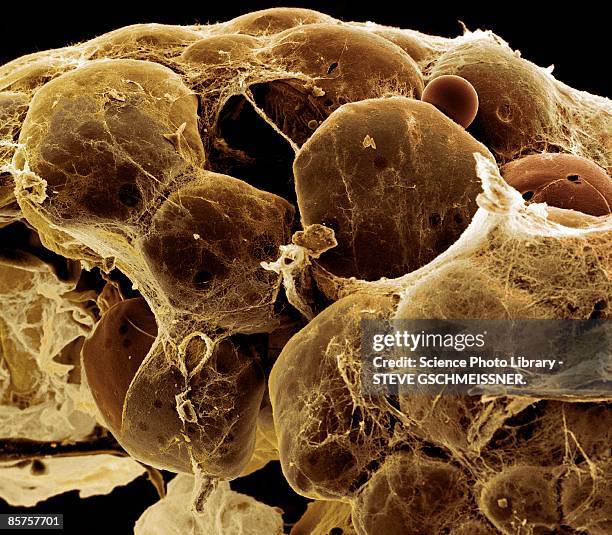 fat tissue, colored scanning electron micrograph - tecido adiposo imagens e fotografias de stock