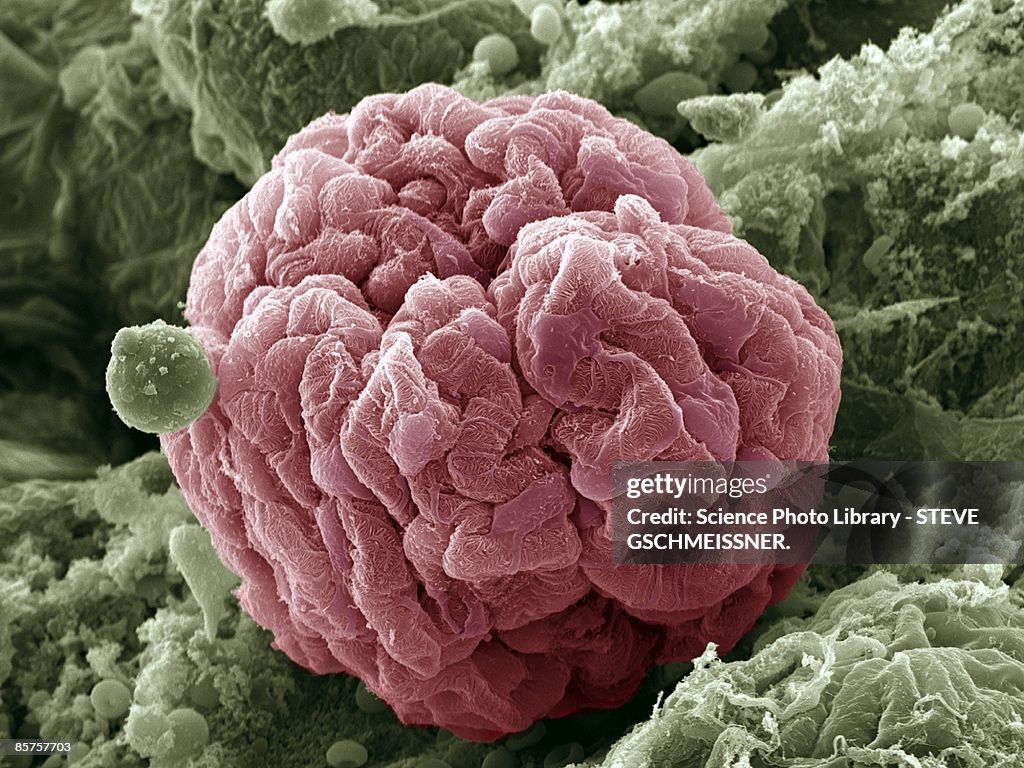 Colored kidney glomerulus scanning electron microscope (SEM)