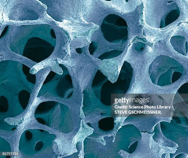bone tissue, close-up - spongy bone stock pictures, royalty-free photos & images