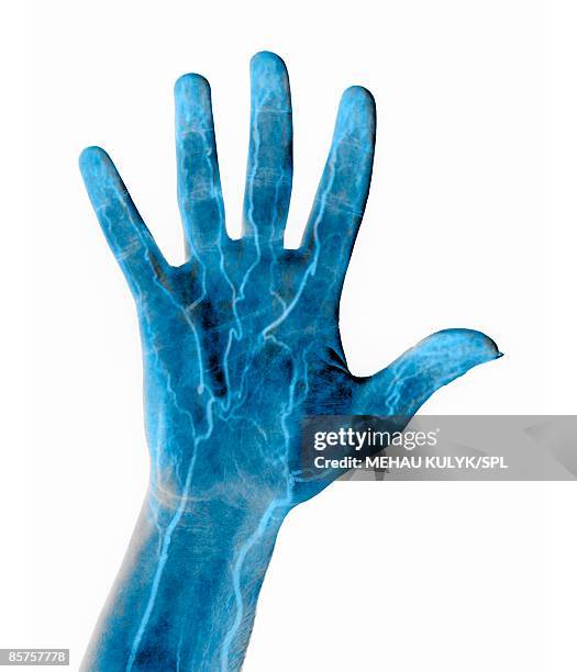 illustrazioni stock, clip art, cartoni animati e icone di tendenza di hand blood supply - human arm