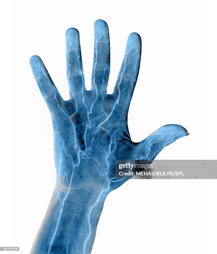 Hand blood supply