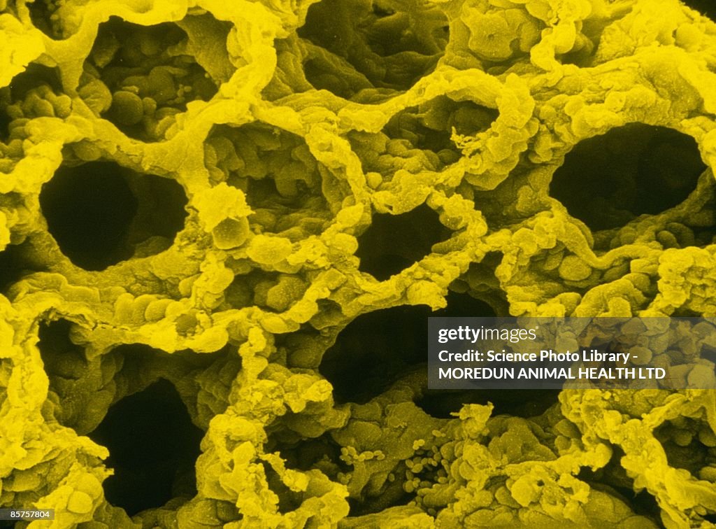 False-color scanning electron micrograph of section of healthy lung tissue