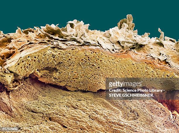 colored scanning electron micrograph of section through healthy skin - hornhaut stock-fotos und bilder