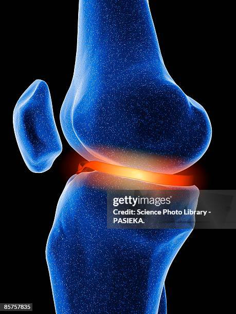 膝を診る目 - The Knee Up Close 352 Knee Close Up High Res Illustrations - Getty Images