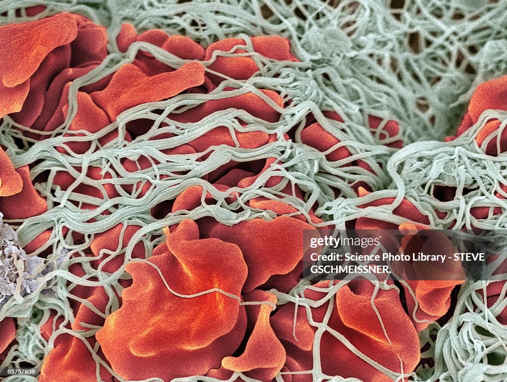 Scanning electron microscope (SEM) of red blood cell