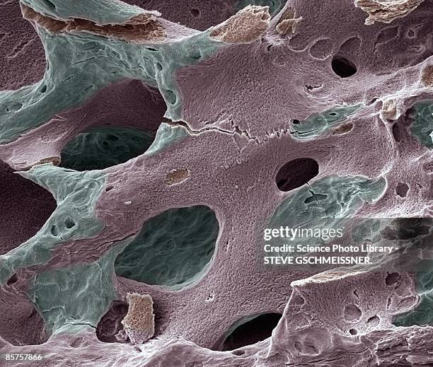 scanning electron micrograph (sem) of human bone, osteoporosis - wissenschaftliche mikroskopische aufnahme stock-fotos und bilder