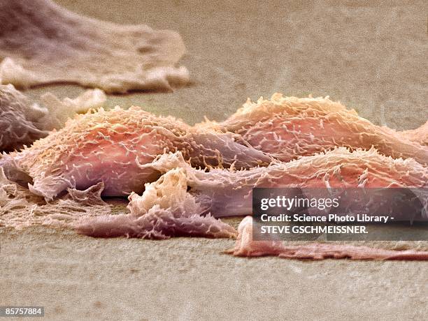 366 Sarkom Stock Photos, HighRes Pictures, and Images Getty Images