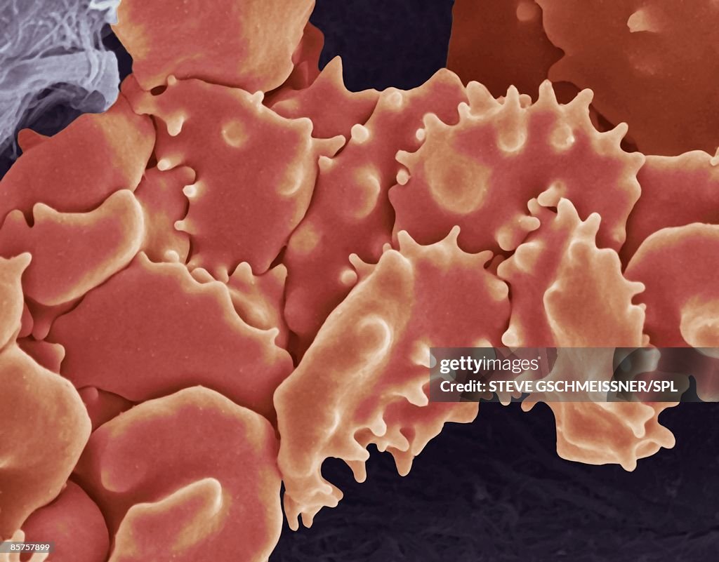 Crenated red blood cells, colored scanning electron micrograph (SEM)