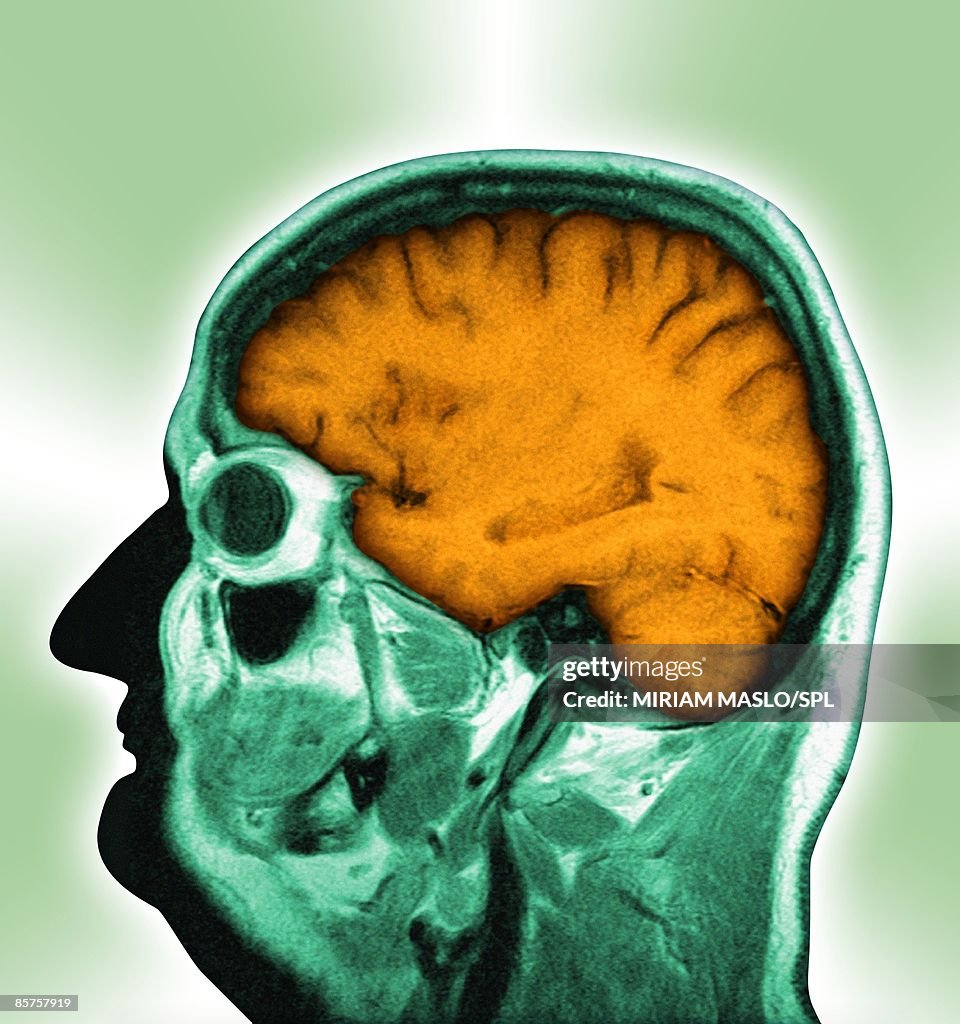 Visualized Brain Normal Normal Human Brain Profile High-Res Stock Photo - Getty Images