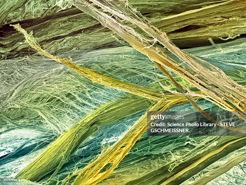Scanning electron micrograph (SEM) of tendon